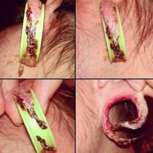graphic blown-out ear